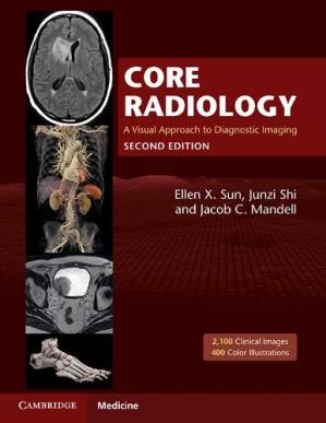 دانلود کتاب Core Radiology: A Visual Approach to Diagnostic Imaging, 2nd Edition