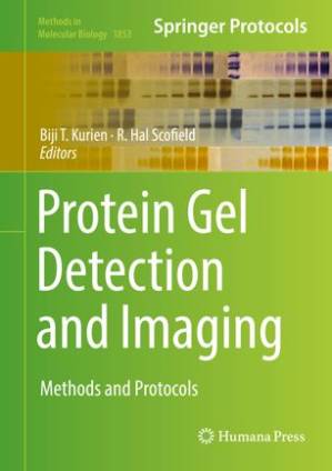 دانلود کتاب Protein Gel Detection and Imaging: Methods and Protocols