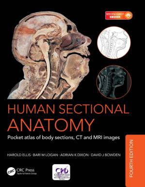 دانلود کتاب Human Sectional Anatomy