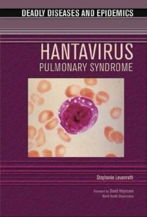 دانلود کتاب Hantavirus Pulmonary Syndrome