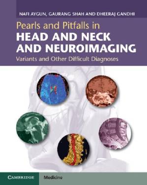 دانلود کتاب Pearls and Pitfalls in Head and Neck and Neuroimaging: Variants and Other Difficult Diagnoses
