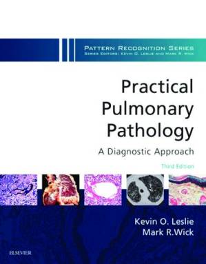 دانلود کتاب Practical Pulmonary Pathology: A Diagnostic Approach: A Volume in the Pattern Recognition Series