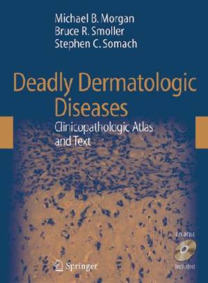 دانلود کتاب Deadly Dermatologic Diseases