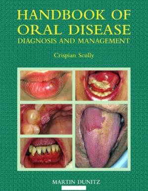 دانلود کتاب Handbook of Oral Disease: Diagnosis and Management