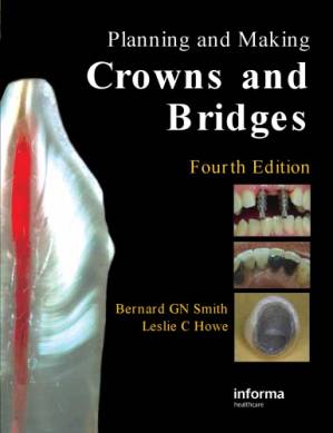 دانلود کتاب Planning and making crowns and bridges