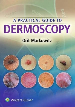 دانلود کتاب A Practical Guide to Dermoscopy