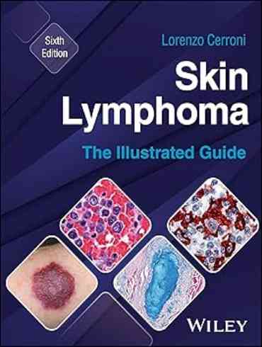 دانلود کتاب Skin Lymphoma: The Illustrated Guide 6th Edition