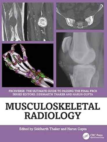 دانلود کتاب Musculoskeletal Radiology: An Ultimate Guide to Passing the Final FRCR 1st Edition