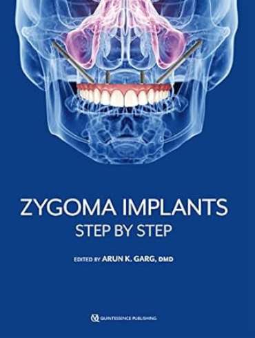 دانلود کتاب Zygoma Implants: Step by Step 1st Edition