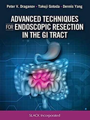دانلود كتاب Advanced Techniques for Endoscopic Resection in the GI Tract 1st Edition