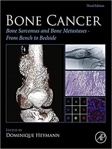 دانلود كتاب Bone Cancer: Bone Sarcomas and Bone Metastases – From Bench to Bedside 3rd Edition