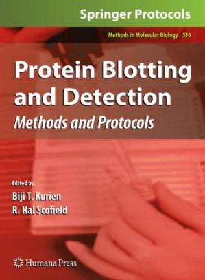 دانلود کتاب Protein Blotting and Detection: Methods and Protocols