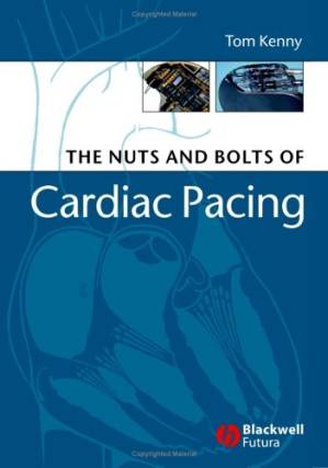 دانلود کتاب Nuts and Bolts of Cardiac Pacing