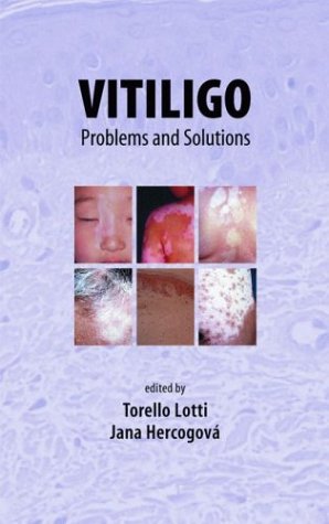 دانلود کتاب Vitiligo: Problems and Solutions