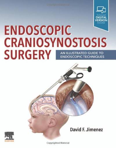 دانلود کتاب Endoscopic Craniosynostosis Surgery: An Illustrated Guide to Techniques