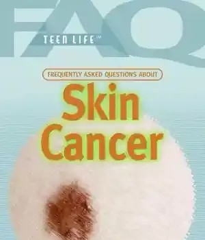دانلود کتاب Frequently Asked Questions about Skin Cancer