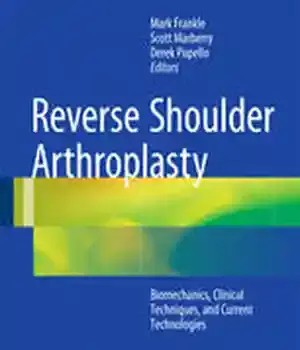دانلود کتاب Reverse Shoulder Arthroplasty: Biomechanics, Clinical Techniques, and Current Technologies