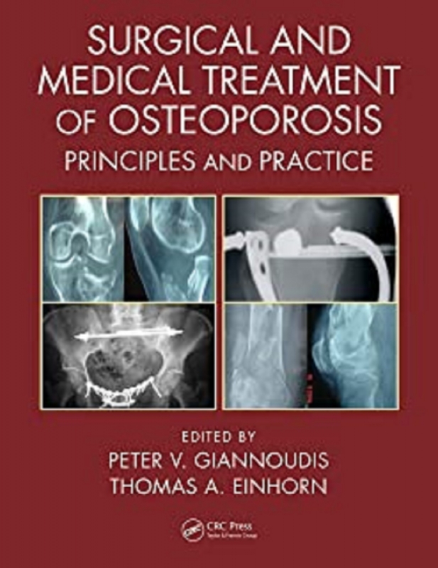 کتاب سرجیکال اند مدیکال ترینمنت آف استئوپوروزیس Surgical and Medical Treatment of Osteoporosis: Principles and Practice 1st Edit