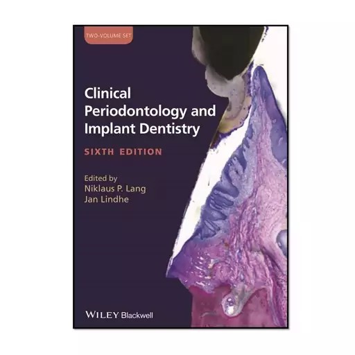 کتاب Clinical Periodontology and Implant Dentistry اثر Niklaus P. Lang و Jan Lindhe دو جلدی کدد b162