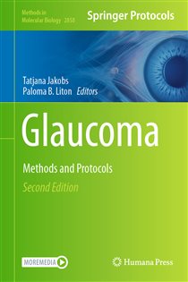 دانلود کتاب Glaucoma (2nd ed.) Methods and Protocols