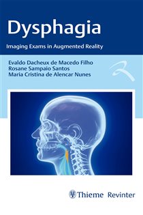 دانلود کتاب Dysphagia Imaging Exams in Augmented Reality
