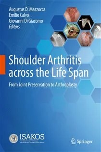 دانلود کتاب Shoulder Arthritis across the Life Span From Joint Preservation to Arthroplasty
