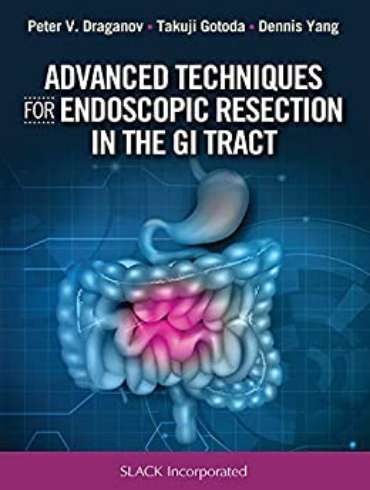 دانلود کتاب Advanced Techniques for Endoscopic Resection in the GI Tract 1st Edition