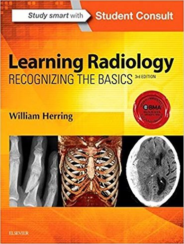 دانلود کتاب Learning Radiology: Recognizing the Basics 3rd Edition + Video
