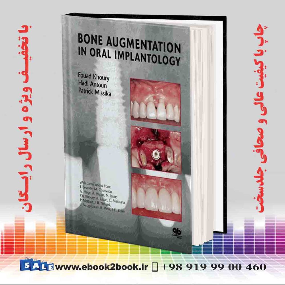 کتاب Bone Augmentation in Oral Implantology