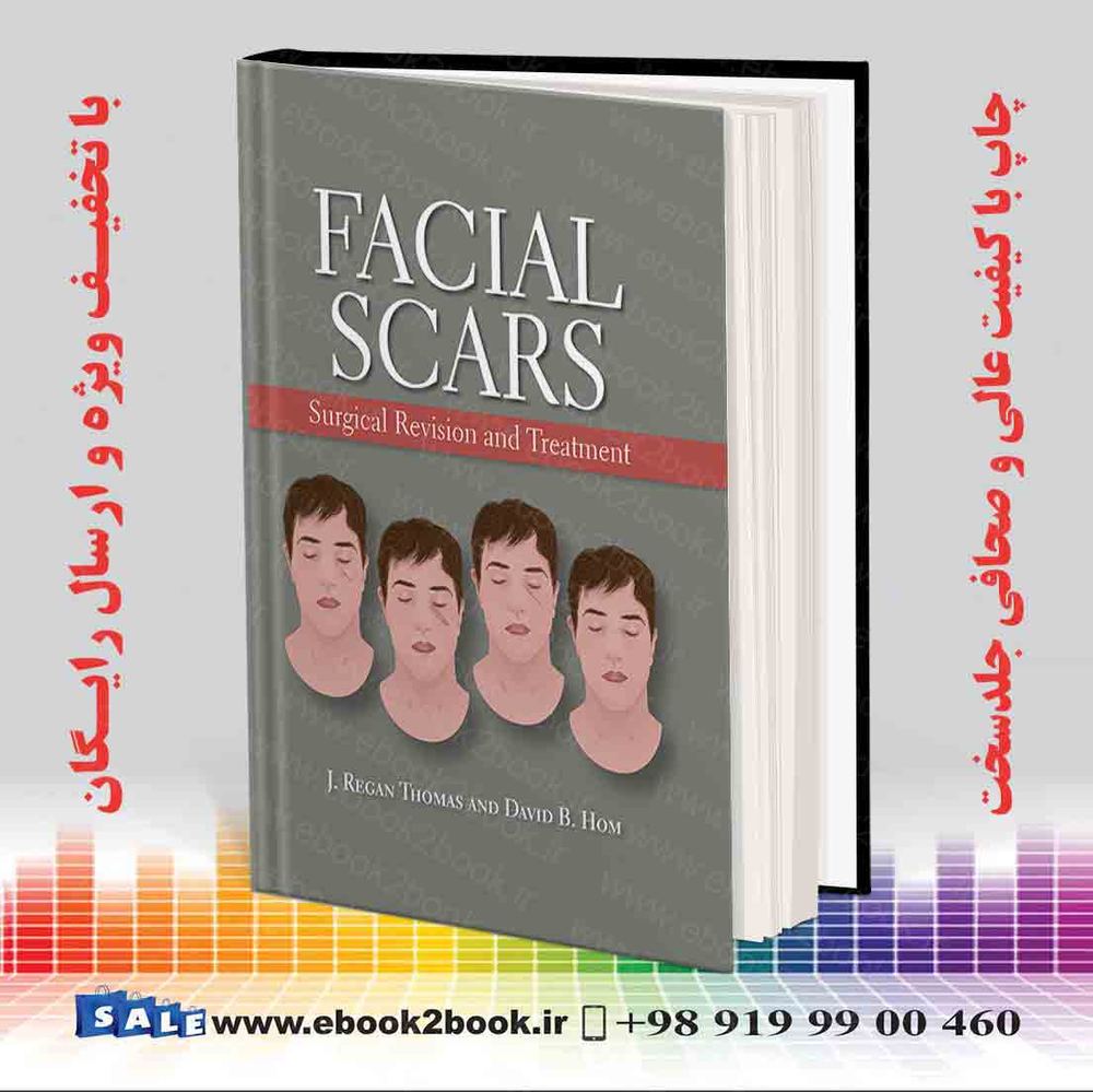 کتاب Facial Scars: Surgical Revision and Treatment