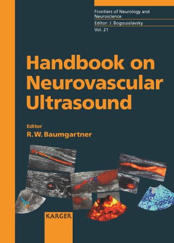 دانلود کتاب Handbook on Neurovascular Ultrasound