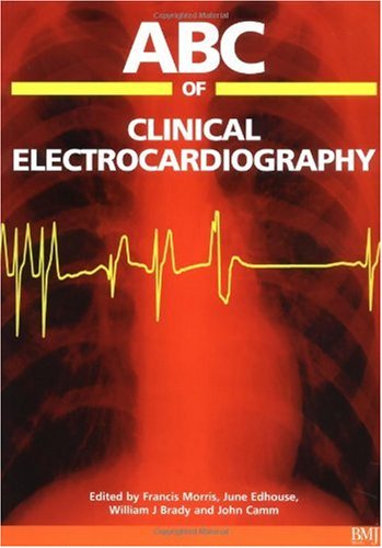 دانلود کتاب ABC of clinical electrocardiography