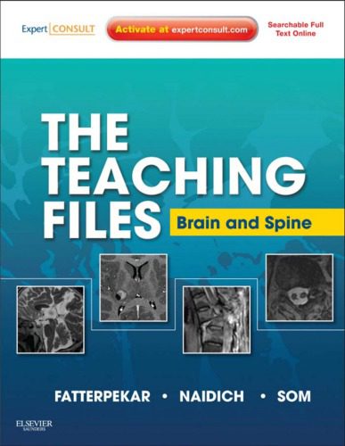 دانلود کتاب Brain and Spine