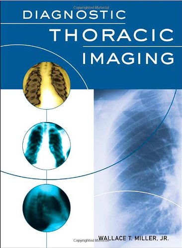 دانلود کتاب Diagnostic Thoracic Imaging