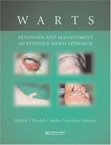 دانلود کتاب Warts: Diagnosis and Management: An Evidence Based Approach