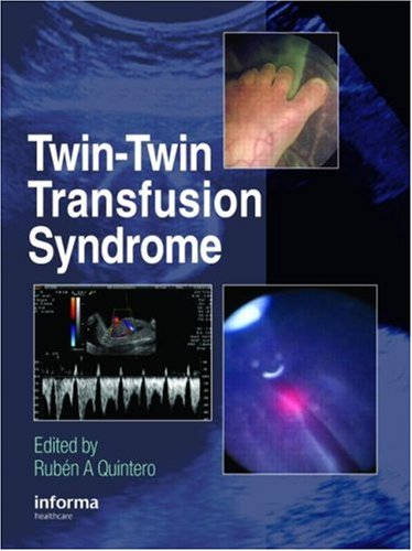 دانلود کتاب Twin-Twin Transfusion Syndrome