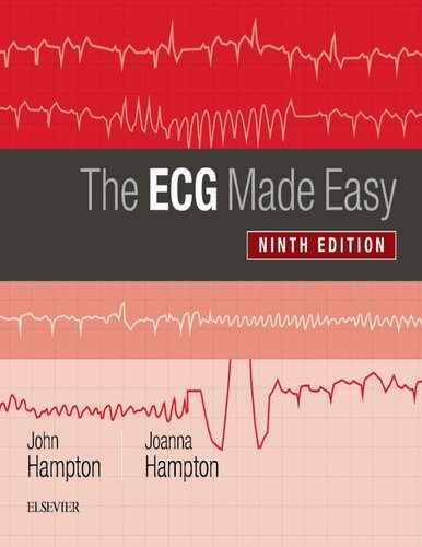 دانلود کتاب The ECG Made Easy ]