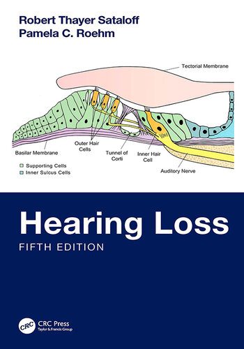 دانلود کتاب Hearing Loss