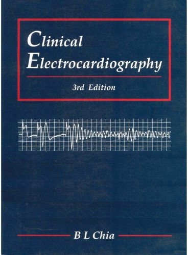 دانلود کتاب Clinical Electrocardiography